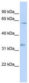 Heat Shock Transcription Factor 2 antibody, TA330166, Origene, Western Blot image 