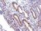 Polypeptide N-Acetylgalactosaminyltransferase 7 antibody, PA5-31458, Invitrogen Antibodies, Immunohistochemistry paraffin image 