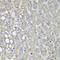 Phosphatidylinositol-4-Phosphate 3-Kinase Catalytic Subunit Type 2 Alpha antibody, A03530, Boster Biological Technology, Immunohistochemistry paraffin image 