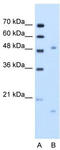 Integrin Subunit Beta Like 1 antibody, TA346381, Origene, Western Blot image 