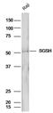 N-Sulfoglucosamine Sulfohydrolase antibody, PA5-72411, Invitrogen Antibodies, Western Blot image 