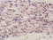 BEN Domain Containing 3 antibody, GTX51985, GeneTex, Immunohistochemistry paraffin image 