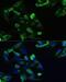 C-X-C Motif Chemokine Receptor 5 antibody, LS-C749241, Lifespan Biosciences, Immunofluorescence image 