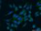 Ribosomal Protein S9 antibody, 18215-1-AP, Proteintech Group, Immunofluorescence image 