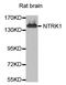 Neurotrophic Receptor Tyrosine Kinase 1 antibody, STJ29781, St John