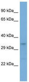 Leucine Rich Repeat Containing 17 antibody, TA339972, Origene, Western Blot image 
