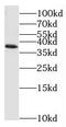 Matrix AAA Peptidase Interacting Protein 1 antibody, FNab01097, FineTest, Western Blot image 