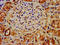 N(Alpha)-Acetyltransferase 38, NatC Auxiliary Subunit antibody, CSB-PA871557LA01HU, Cusabio, Immunohistochemistry paraffin image 