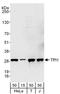 Triosephosphate Isomerase 1 antibody, A303-754A, Bethyl Labs, Western Blot image 