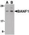 Barrier-to-autointegration factor antibody, PA5-20328, Invitrogen Antibodies, Western Blot image 