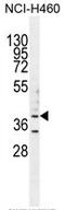 Beta-1,3-Galactosyltransferase 5 antibody, AP50323PU-N, Origene, Western Blot image 