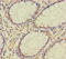 TATA-Box Binding Protein Associated Factor 12 antibody, A56964-100, Epigentek, Immunohistochemistry paraffin image 