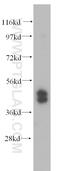 TARBP2 Subunit Of RISC Loading Complex antibody, 15753-1-AP, Proteintech Group, Western Blot image 