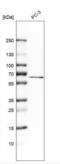 Mucolipin 1 antibody, NBP1-92152, Novus Biologicals, Western Blot image 
