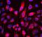 MTUS1 antibody, A04047-1, Boster Biological Technology, Western Blot image 