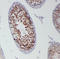 DEAD-Box Helicase 4 antibody, LS-C313094, Lifespan Biosciences, Immunohistochemistry paraffin image 