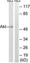 Protein kinase B antibody, TA313268, Origene, Western Blot image 