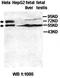 ADAM Metallopeptidase Domain 21 antibody, orb77734, Biorbyt, Western Blot image 