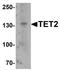 Methylcytosine dioxygenase TET2 antibody, TA319944, Origene, Western Blot image 