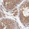 Ribonuclease A Family Member 11 (Inactive) antibody, HPA003724, Atlas Antibodies, Immunohistochemistry frozen image 