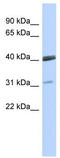 Visual System Homeobox 1 antibody, TA343742, Origene, Western Blot image 