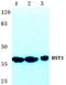 Bone Marrow Stromal Cell Antigen 1 antibody, A05818, Boster Biological Technology, Western Blot image 