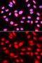 U2 Small Nuclear RNA Auxiliary Factor 2 antibody, GTX55828, GeneTex, Immunofluorescence image 