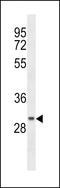 Coiled-Coil Domain Containing 24 antibody, LS-C159287, Lifespan Biosciences, Western Blot image 