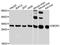 2,4-Dienoyl-CoA Reductase 1 antibody, A13014, ABclonal Technology, Western Blot image 