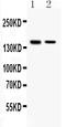 HET antibody, PB10095, Boster Biological Technology, Western Blot image 