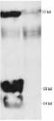 Acetylated-Lysine antibody, ADI-KAP-TF1201B-E, Enzo Life Sciences, Western Blot image 