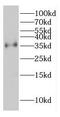 Coatomer Protein Complex Subunit Epsilon antibody, FNab01865, FineTest, Western Blot image 