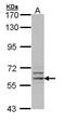 Glucose-6-phosphate 1-dehydrogenase antibody, GTX113186, GeneTex, Western Blot image 