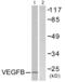 Vascular Endothelial Growth Factor B antibody, abx013248, Abbexa, Western Blot image 