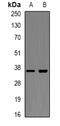 X-Box Binding Protein 1 antibody, abx141625, Abbexa, Western Blot image 