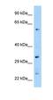 Zinc Finger Protein 664 antibody, orb325678, Biorbyt, Western Blot image 
