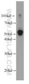 Iduronate 2-Sulfatase antibody, 66112-1-Ig, Proteintech Group, Western Blot image 