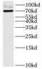 Holliday junction recognition protein antibody, FNab03892, FineTest, Western Blot image 