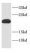 NADH:Ubiquinone Oxidoreductase Subunit A12 antibody, FNab02237, FineTest, Western Blot image 