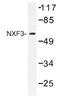 Nuclear RNA Export Factor 3 antibody, AP01412PU-N, Origene, Western Blot image 