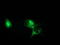 Catenin Beta 1 antibody, LS-C172582, Lifespan Biosciences, Immunofluorescence image 