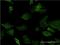 Distal-Less Homeobox 5 antibody, H00001749-M09, Novus Biologicals, Immunocytochemistry image 