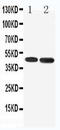 5-Hydroxytryptamine Receptor 1A antibody, LS-C312804, Lifespan Biosciences, Western Blot image 