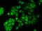 Estrogen Related Receptor Alpha antibody, 207497-T02, Sino Biological, Immunohistochemistry frozen image 
