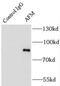 Afamin antibody, FNab00200, FineTest, Immunoprecipitation image 