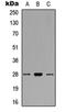Thymosin Beta 4 X-Linked antibody, orb304650, Biorbyt, Western Blot image 