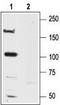 NMDAR2A antibody, TA328821, Origene, Western Blot image 