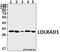Low Density Lipoprotein Receptor Class A Domain Containing 1 antibody, A15115-1, Boster Biological Technology, Western Blot image 