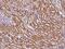 Zinc finger protein GLIS1 antibody, 103978-T08, Sino Biological, Immunohistochemistry paraffin image 