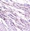 Fatty Acid Binding Protein 3 antibody, M01734, Boster Biological Technology, Immunohistochemistry paraffin image 